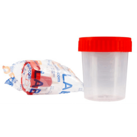 Urine Cup Sterile and Non-Sterile