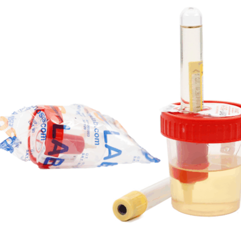 Vacuum Urine Cup and Tube (Sterile & Non-Sterile)